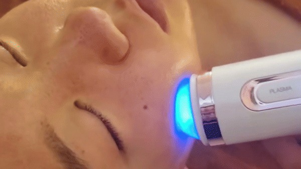 Uprise Plasma Pen 2nd Gen